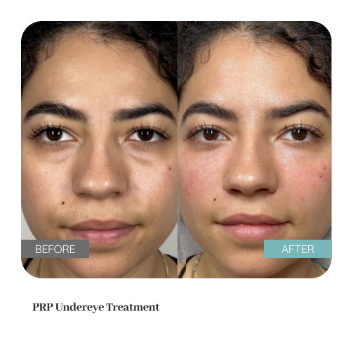 Before and after result